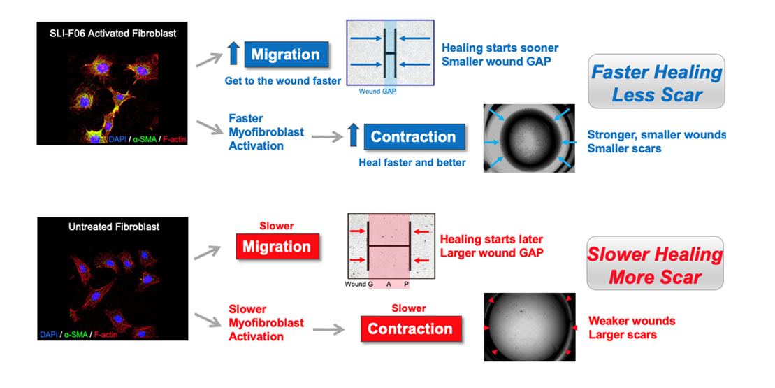 fibroblast